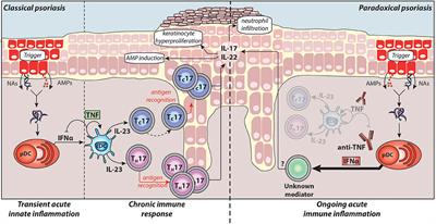 Psoriasis: Classical vs. Paradoxical. The Yin-Yang of TNF and Type I Interferon